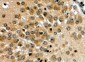 NOTCH3 Antibody (C-Term)